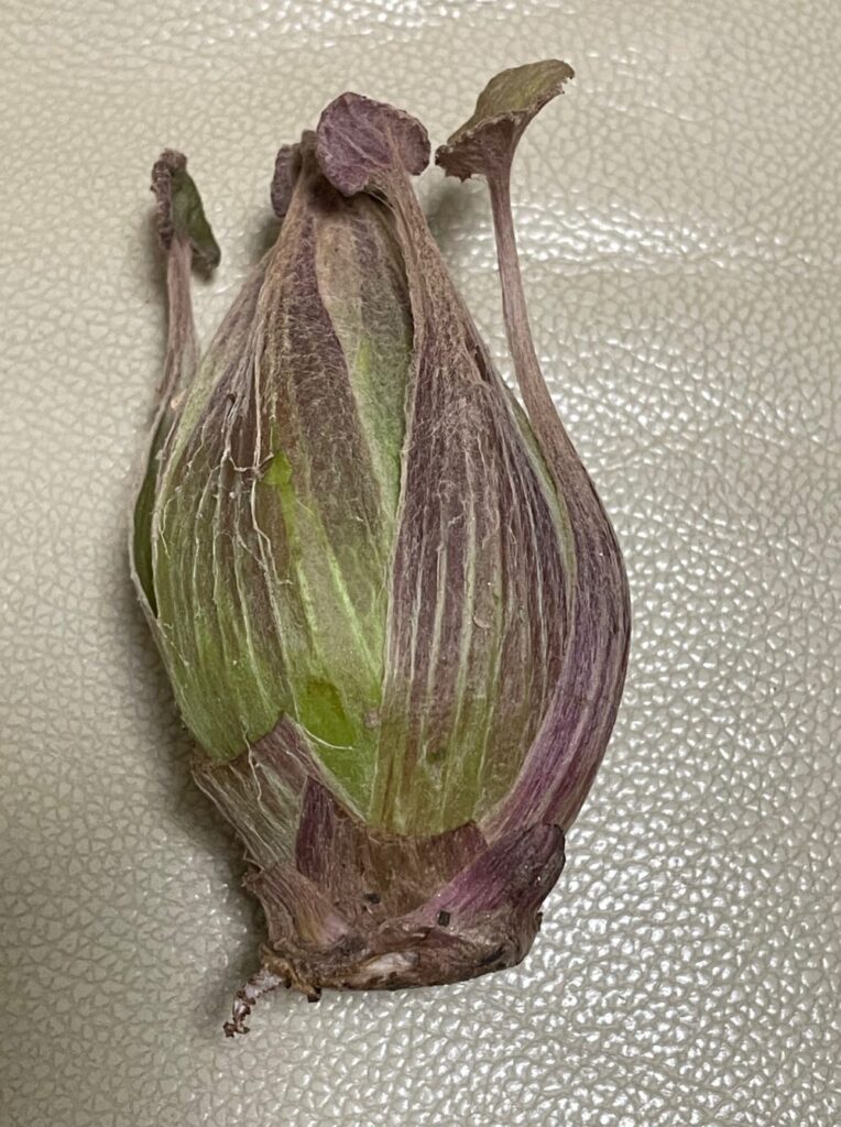 更年期と低音障害型感音難聴